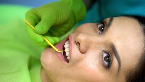 Sealants in Colorado Springs, CO Dental Sealants